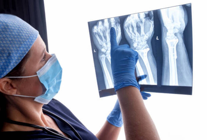 Tumori, rischio fratture più alto per pazienti oncologici
