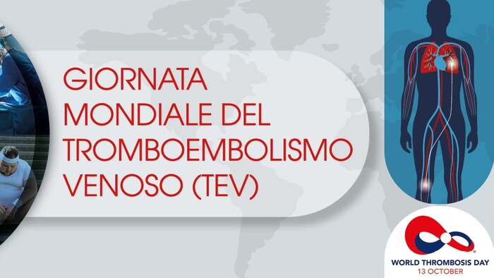 Pazienti ricoverati a rischio trombosi,consigli per evitarla