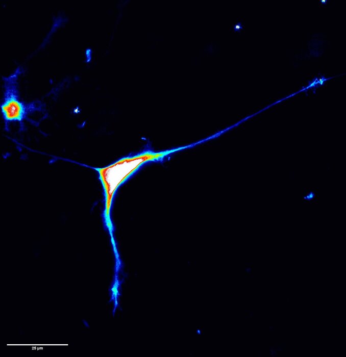 Scoperto un nuovo gene responsabile dell'autismo